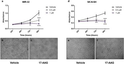 A Novel Mechanism of 17-AAG Therapeutic Efficacy on HSP90 Inhibition in MYCN-Amplified Neuroblastoma Cells